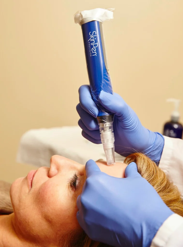 Skinpen Microneedling in Park Ridge IL